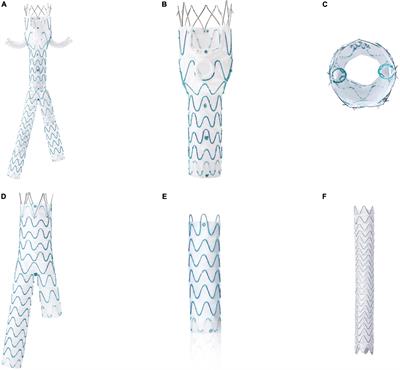 A prospective, multicenter, single-arm clinical trial cohort to evaluate the safety and effectiveness of a novel stent graft system (WeFlow-JAAA) for the treatment of juxtarenal abdominal aortic aneurysm: A study protocol
